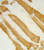 ITPKC Antibody in Immunohistochemistry (IHC)