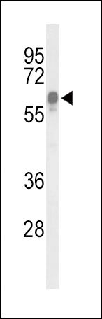 ITPKC Antibody in Western Blot (WB)