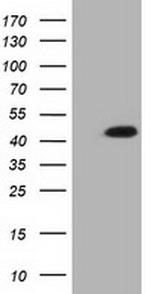 IVD Antibody in Western Blot (WB)