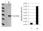 Human IkB alpha (Phospho) [pS32/pS36] InstantOne™ ELISA Kit