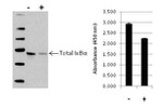 Human IkB alpha (Total) InstantOne™ ELISA Kit