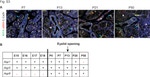 E-cadherin Antibody in Immunohistochemistry (IHC)