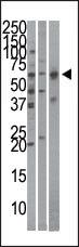 KPNA4 Antibody in Western Blot (WB)