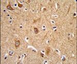 CD49f Antibody in Immunohistochemistry (IHC)