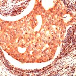 JAB1 Antibody in Immunohistochemistry (IHC)