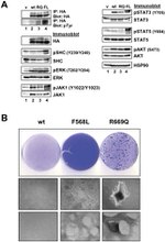 Phospho-JAK1 (Tyr1034, Tyr1035) Antibody in Western Blot (WB)