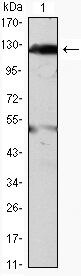 JAK2 Monoclonal Antibody (1C1)