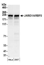 JARID1A/RBP2 Antibody in Western Blot (WB)