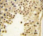 KDM2A Antibody in Immunohistochemistry (IHC)