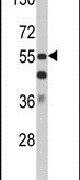 KDM2A Antibody in Western Blot (WB)