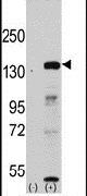 KDM2A Antibody in Western Blot (WB)