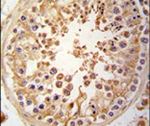 JLP Antibody in Immunohistochemistry (IHC)
