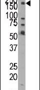 JMJD1B Antibody in Western Blot (WB)