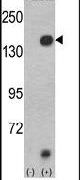 JMJD2A Antibody in Western Blot (WB)