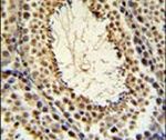 JMJD2B Antibody in Immunohistochemistry (IHC)