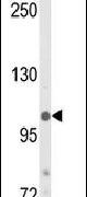 JMJD2B Antibody in Western Blot (WB)