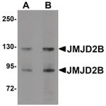JMJD2B Antibody in Western Blot (WB)