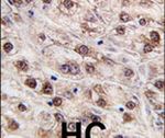 JMJD4 Antibody in Immunohistochemistry (IHC)