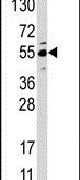 JMJD4 Antibody in Western Blot (WB)
