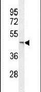 JMJD5 Antibody in Western Blot (WB)