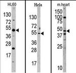 JMJD6 Antibody in Western Blot (WB)