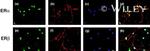 Estrogen Receptor beta Antibody in Immunocytochemistry (ICC/IF)