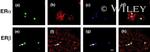 Estrogen Receptor beta Antibody in Immunocytochemistry (ICC/IF)
