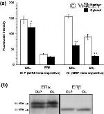Estrogen Receptor beta Antibody in Western Blot (WB)