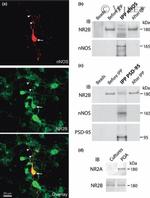 NMDAR2B Antibody in Western Blot, Immunocytochemistry (WB, ICC/IF)
