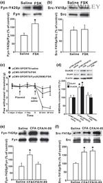 Phospho-SRC (Tyr419) Antibody in Western Blot (WB)