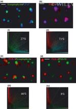 PSD-95 Antibody in Immunocytochemistry (ICC/IF)