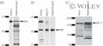 Estrogen Receptor beta Antibody in Western Blot (WB)