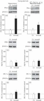 Estrogen Receptor beta Antibody in Western Blot (WB)