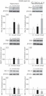 Estrogen Receptor beta Antibody in Western Blot (WB)