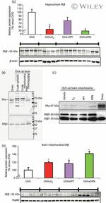 Estrogen Receptor beta Antibody in Western Blot (WB)