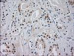 JNK1 Antibody in Immunohistochemistry (Paraffin) (IHC (P))