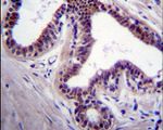 JNK1 Antibody in Immunohistochemistry (IHC)