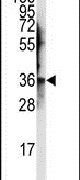 JTV-1 Antibody in Western Blot (WB)