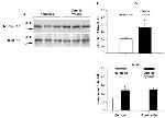 Phospho-FAK (Tyr397) Antibody in Western Blot (WB)