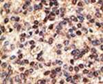 Jagged2 Antibody in Immunohistochemistry (IHC)