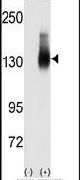 Jagged2 Antibody in Western Blot (WB)
