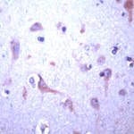 JM4 Antibody in Immunohistochemistry (IHC)