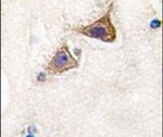 JPH3 Antibody in Immunohistochemistry (IHC)