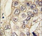 K-cadherin Antibody in Immunohistochemistry (IHC)