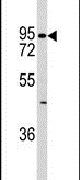 K-cadherin Antibody in Western Blot (WB)