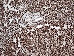 KARS Antibody in Immunohistochemistry (Paraffin) (IHC (P))
