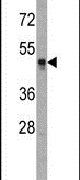 HAT1 Antibody in Western Blot (WB)