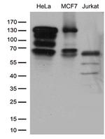 KAT5 Antibody in Western Blot (WB)
