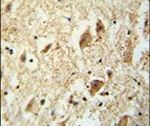 KATNAL1 Antibody in Immunohistochemistry (IHC)