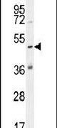 KATNAL1 Antibody in Western Blot (WB)
